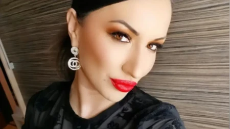 Pevačicu pretukao bivši dečko! Lice joj je svo u modricama, posle tuče završila u bolnici: "Nisam dobro"