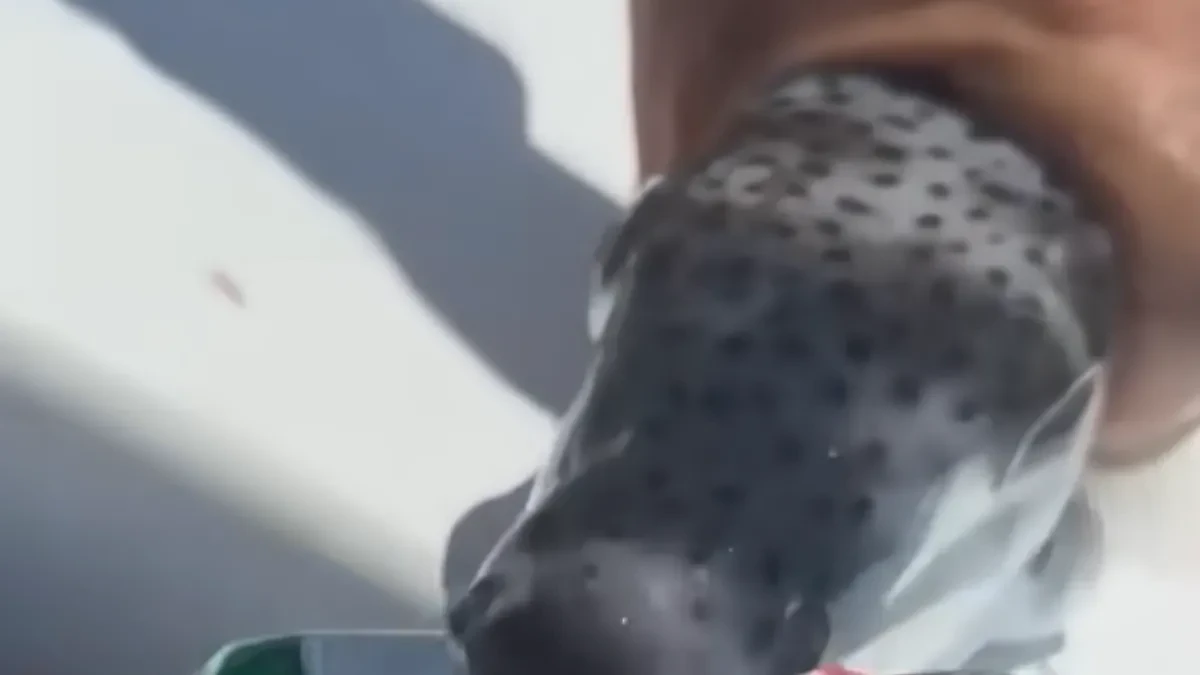 Riba zec ugrizla nesrećnu ženu na popularnoj plaži u Grčkoj: Jedan detalj je posebno jeziv!