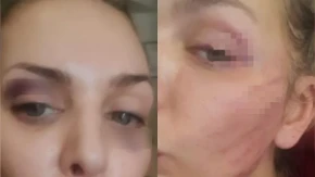 Prebio je, a sad se pomirila sa njim?! Ava Karabatić posle brutalog nasilja opet sa bivšim: "Pili su alkohol"