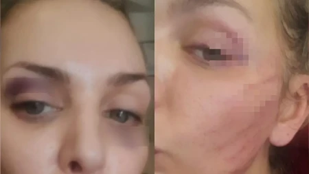 Prebio je, a sad se pomirila sa njim?! Ava Karabatić posle brutalog nasilja opet sa bivšim: "Pili su alkohol"