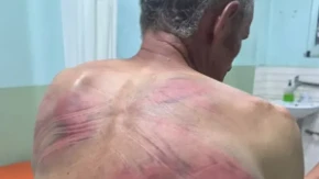 "Rašković nije slučajno napadnut, izabrali su čoveka koji je na neki način simbol" Kajtez progovorio o teroru Kurtijevih policajaca nad Srbinom