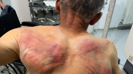 "Rašković ima kontuziju glave, povrede grudnog koša, slomljeno rebro, psihičku traumu" Elek: Ovde nije reč samo o prebijanju, ovo je pokušaj ubistva