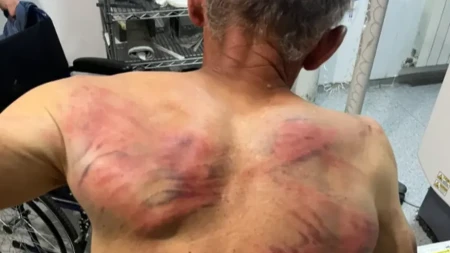 Srbina izvukli iz kuće, vezali za drvo i brutalno pretukli! Linta besan: „Ljudska prava za nas ne važe?!“