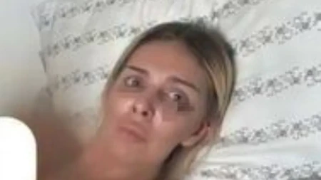 Ava Karabatić gola vezana za krevet: Pokazala modrice, jeziva fotka ledi krv u žilama! (FOTO 18+)