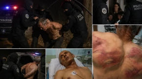 Tukli ga dok su mu deca plakala! Potresne reči prebijenog Nenada iz bolničke postelje paraju dušu: „Ja nemam kud“