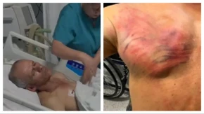 Srbin kog je tukla Kurtijeva policija u šok sobi! Vezali su ga za drvo i tukli crevom, ima teške povrede