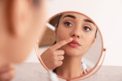 Herpes na usni? Evo šta da uradite odmah da nestane za 24 sata