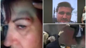 Prvo tukli žene, sada prete silovanjem: Kako je evoluirala blokaderska politika nasilja nad nežnijim polom (FOTO)