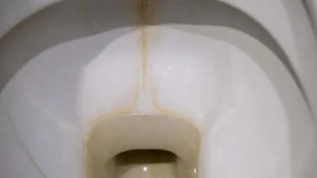 Preko noći stavite ovo u WC šolju: Ujutro neće biti nijedne mrlje od kamenca