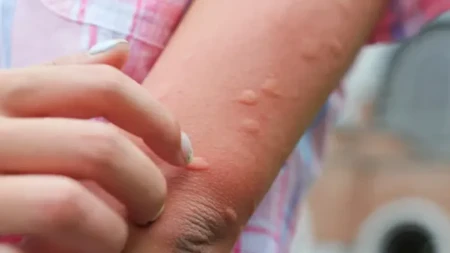 Komarci od ovoga beže glavom bez obzira: Klopka za koju vam ne treba bukvalno ništa, a provereno će ih oterati